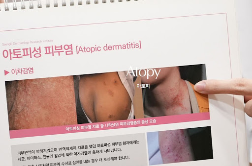 생기한의원이 정리한 아토피 증상 부위별 특징 안내